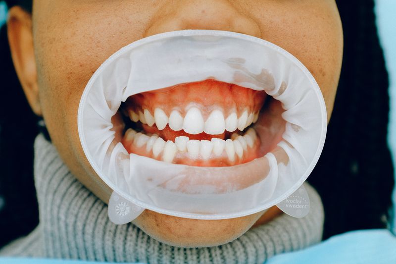 a close-up photo of teeth and gums